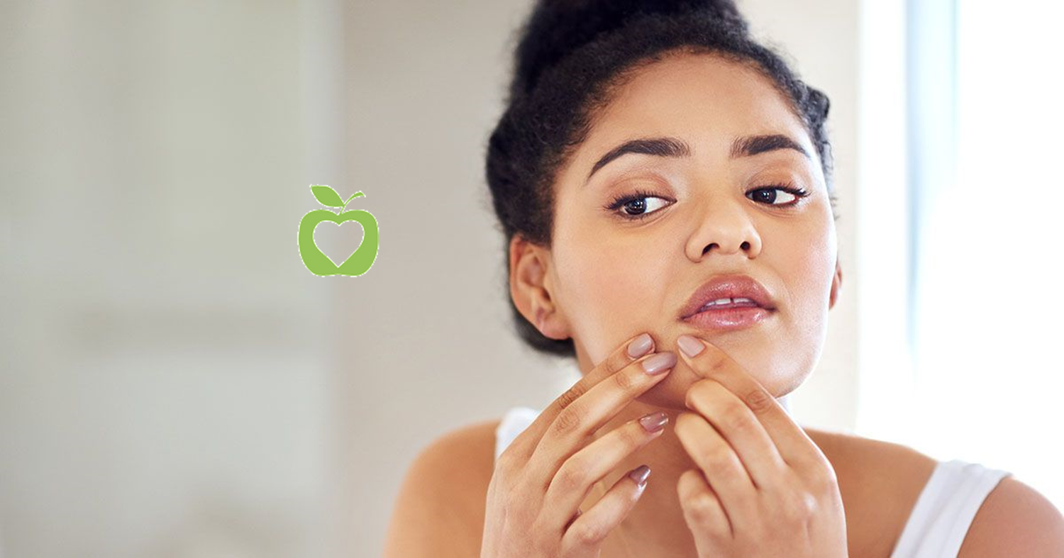 6 Surprising Foods That May Be Contributing to Your Acne